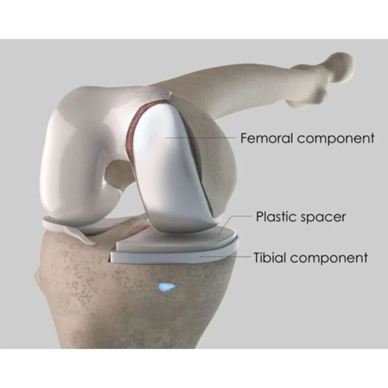 Air Ambulance Patient Transfer